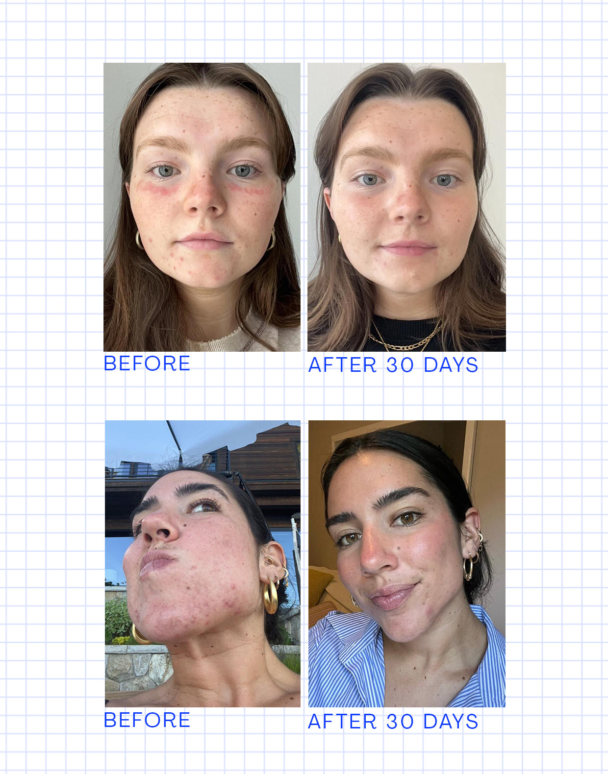 Daily Essentials Regimen Bundle