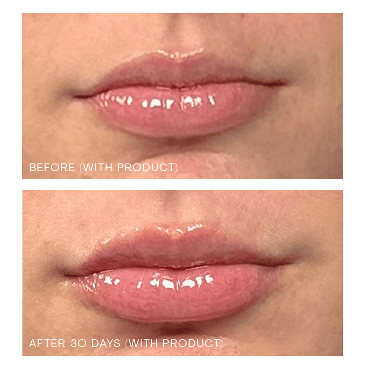 The Ultimate Lip Oasis Set