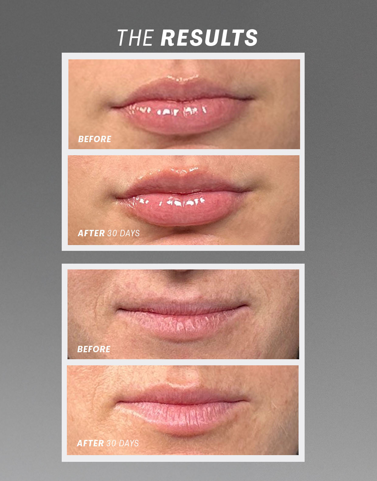 Lip Oasis™️ Glossy Treatment